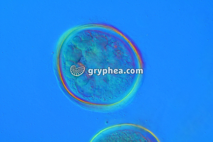 Petite douve du foie - ver parasite - Metacercaire (Fasciola hepatica) x100 - gryphea.com